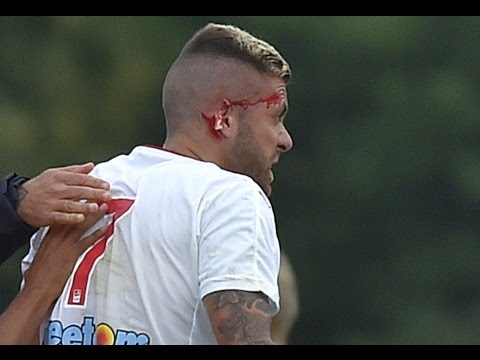 قطع أذن جيريمى مينيز فى أول مباراة له مع بوردو الفرنسى