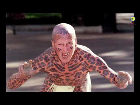 أبشع عمليات التجميل في التاريخ