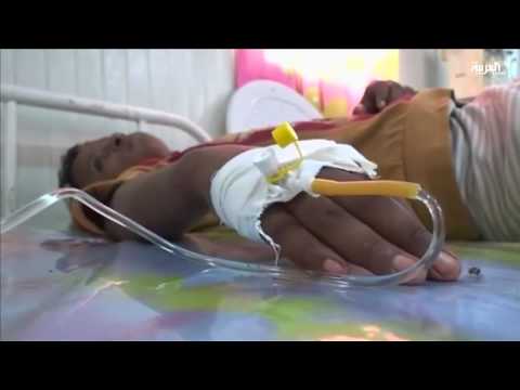 بالفيديو انقلابيو اليمن يمنعون وصول الغذاء والدواء إلى الأطفال المرضى