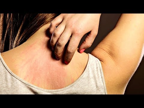 شاهد 8 علامات مبكرة تدل على الإصابة بالسرطان