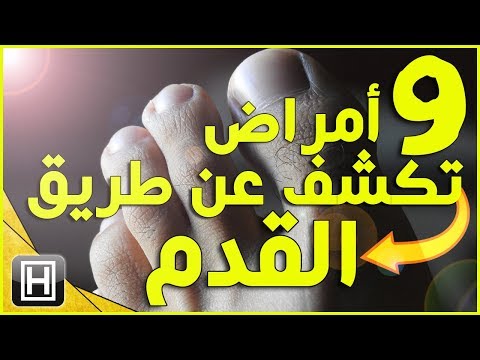 شاهد 9 أمراض خطيرة يمكن كشفها عن طريق القدم