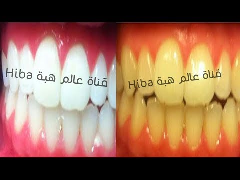 بالفيديو تعرفي علي وصفة تبييض الاسنان في دقيقتين