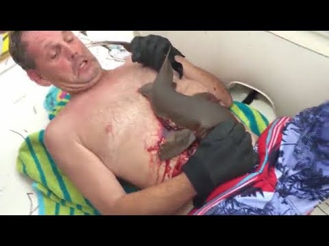 الفيديو سمكة قرش تعض غواصًا من بطنه وترفض تركه