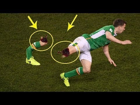 شاهد إصابات بشعة حطمت حياة اللاعبين ومسيرتهم