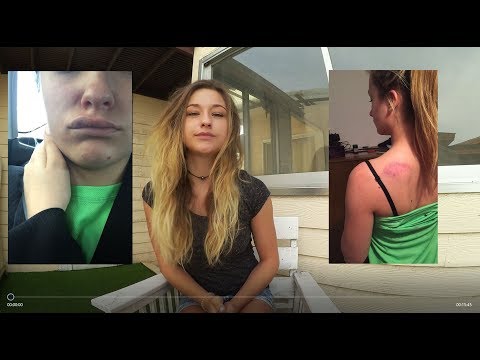 شاهد الفتاة التي اتهمت لمجرد باغتصابها تروي تفاصيل الحادث