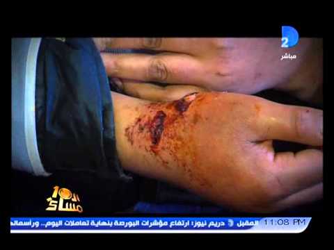 السلعوة تظهر مجددًا في طنطا وتهاجم الأطفال