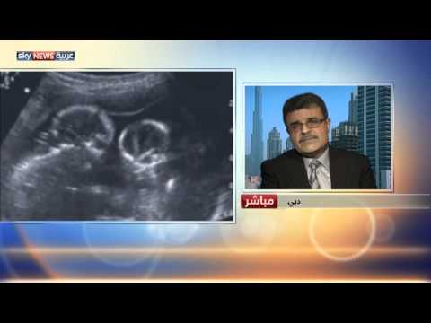 زيادة وزن الحامل خطر على الجنين