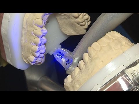 بالفيديو إماجينيلا دينتيل يسلط الضوء على أحدث الإبتكارات في طب الأسنان