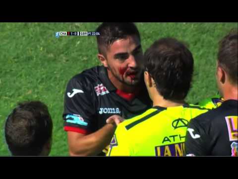 شاهد الدماء تسيل من فم لاعب في الدوري الأرجنتيني