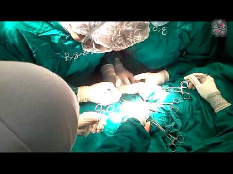 شاهد افتتاح وحدة لجراحة عظام الأطفال في أسيوط