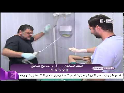 بالفيديو كيفية إجراء عملية شفط دهون البطن وشدها